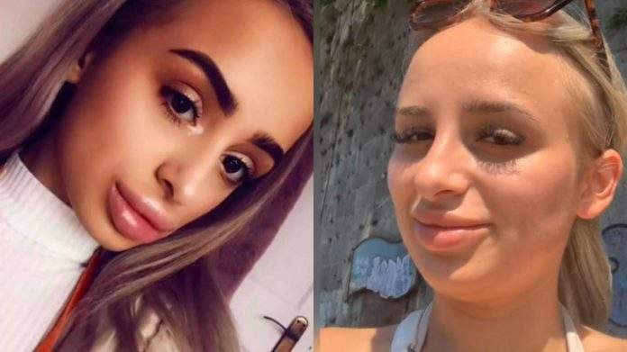 Dvije godine je bila ovisna o filerima za usne: ''Unakazila sam se, stalno su me vrijeđali''
